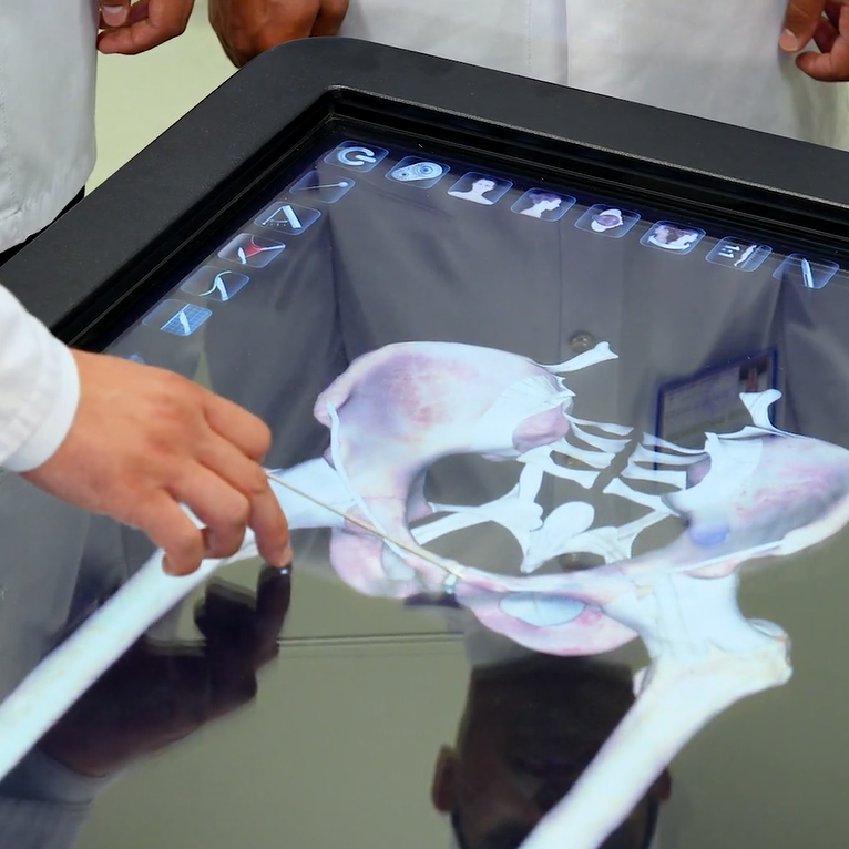 A&yacute;ak s&uuml;ňkleriniň birleşmeleri. &Ccedil;anaklyk s&uuml;ňkleriniň birleşmeleri. &Ccedil;anaklyk-but, dyz, injik-daban bogunlary. Anatomage 3D enjamynda amaly sapak.